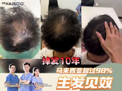 DrHairMo Ampang