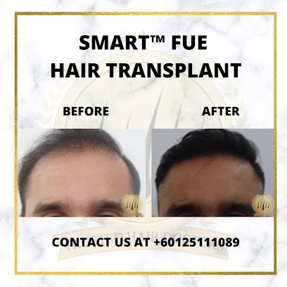 SMART FUE Hair Transplant